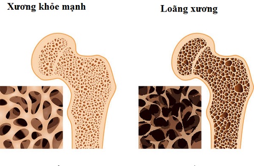 America successfully recreates bones from stem cells