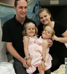 America: Successfully separated two twin girls conjoined from belly to leg