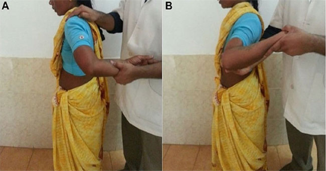 An Indian woman can rotate her arms 180 degrees