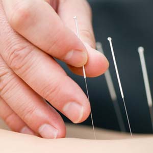 An Oriental medicine is popular in the West