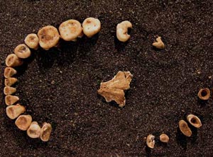 Ancient people also had orthodontic correction
