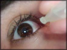 Anemia due to eye drops