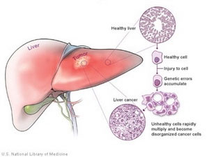 Announcing important findings about liver cancer