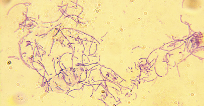 Anthrax bacteria - scary biological weapons!