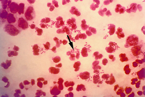 Antibacterial detection against all antibiotics