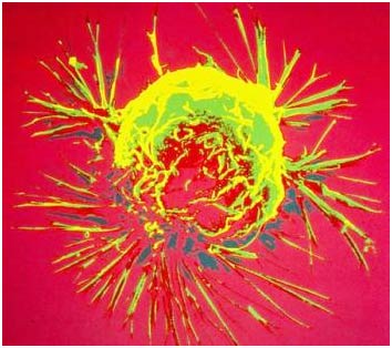 Anti-cancer genes may slow down aging