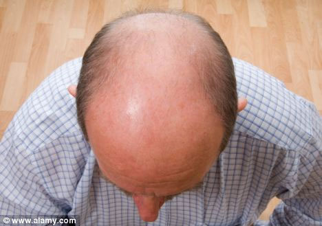 Appearance of topical cream for baldness