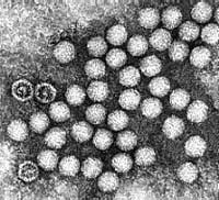 Application of PCR techniques to diagnose encephalitis and meningitis