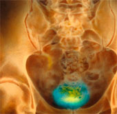 Artificial bladder