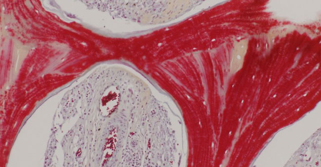 Artificial bone from transplanted pig cells for humans