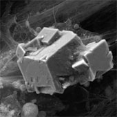 Artificial bones from umbilical cord stem cells