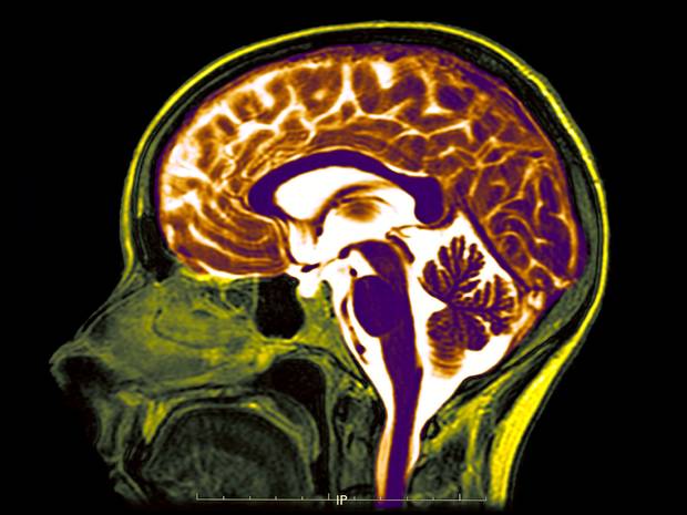 Artificial brain - the door to open life
