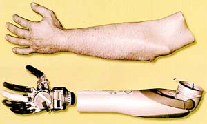 Artificial hands are just like the real thing