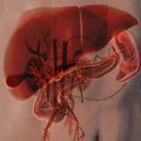 Artificial liver culture from newborn umbilical cord