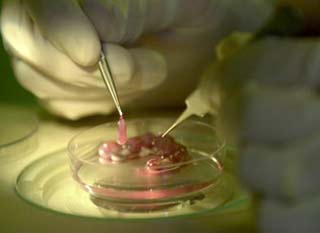 Artificial liver transplant