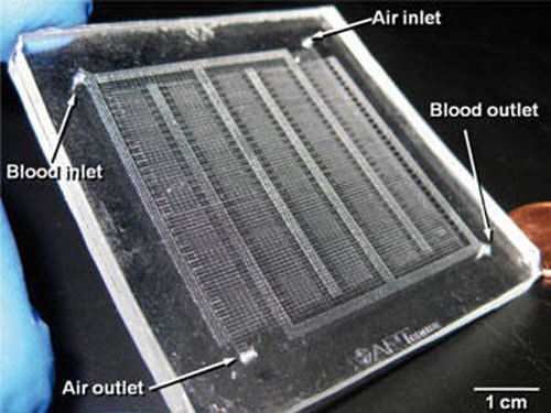 Artificial lung