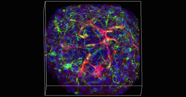Artificial mini brains can produce blood vessels themselves