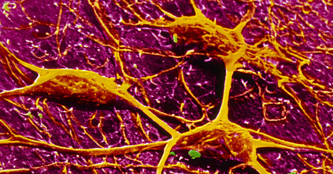 Artificial neurons are faster than human brain