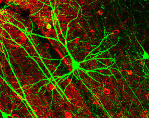 artificial-neurons-replace-nerves-in-the-human-brain