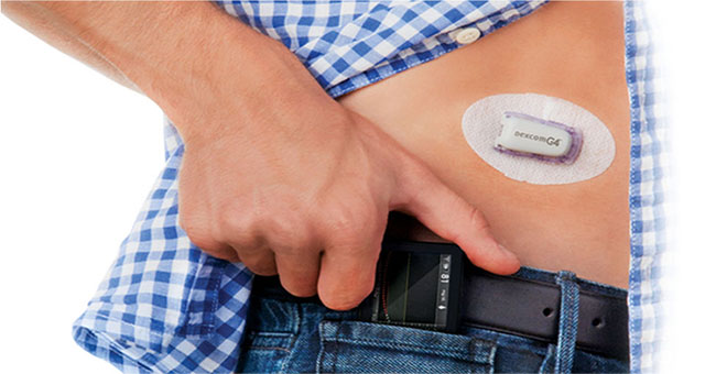 Artificial pancreas smart, future for diabetics