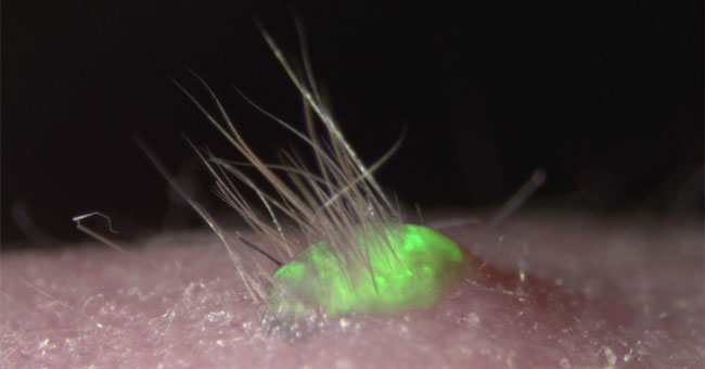 Artificial skin has hair and sweat glands