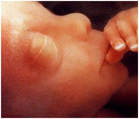 Artificial uterus