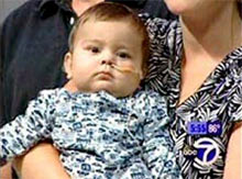 At the age of 8 months, 5 organs were grafted