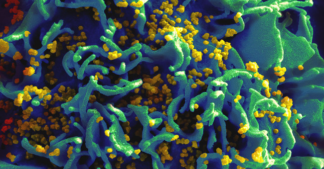 Australia claims AIDS is no longer a public health issue
