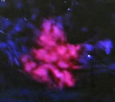 Australia: New drug that helps cancer cells glow