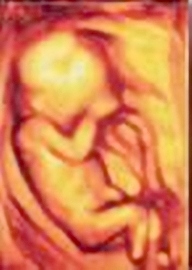 Australia: Successful surgery on the fetus