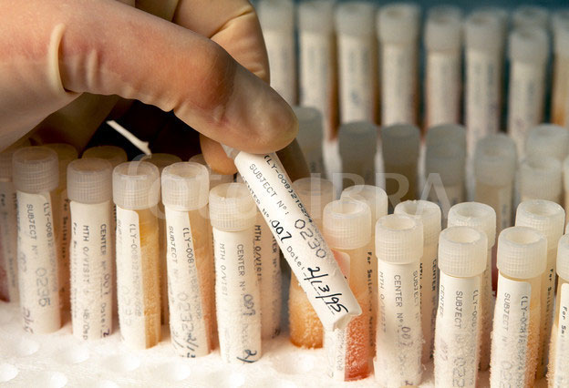 Australia tested frozen blood at the hospital