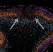 Autism originates from brain changes in the fetus?