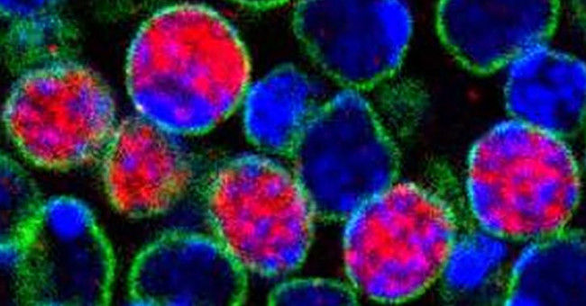 Awakening 'dormant' cells helps the brain heal itself