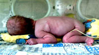 Babies do not have a mouth in Ukraine