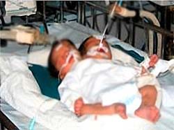 Babies have two heads