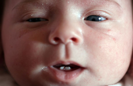 Baby girl was born smiling with 2 front teeth