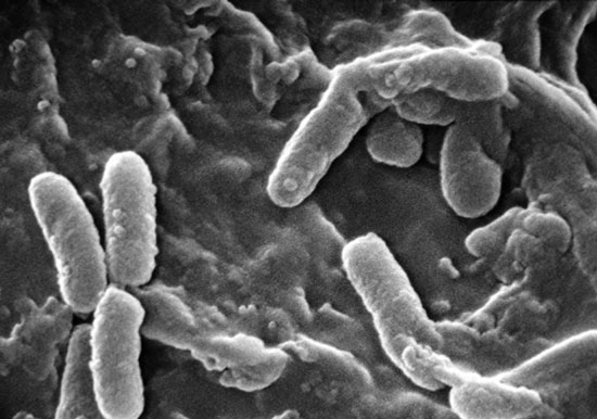 Bacteria also know 'suicide bombing'
