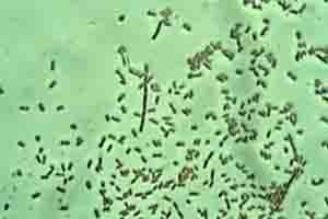 Bacteria by antibiotics