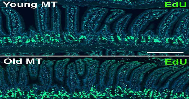 Bacteria in the gut can change the aging process