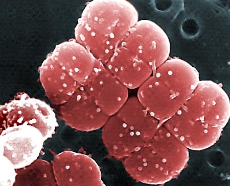 Bacteria live millions of years on Mars