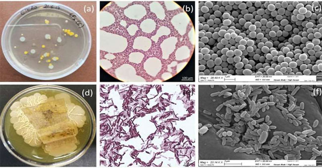 Bacteria protect ancient paintings from bacteria that eat pigments