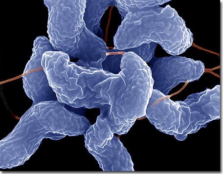 Bacteria reunite after millions of years of separation