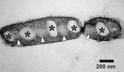 Bacteria specializing in oil consumption