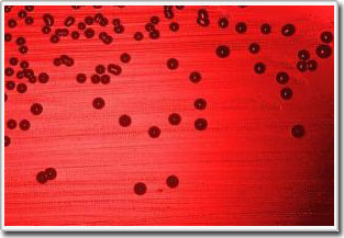 Bacteria that wear 'invisibility cloak' escape the human immune system