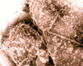 Bacteria turn soil into gold