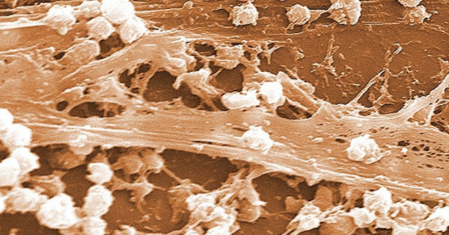 Bacteria turned out to talk