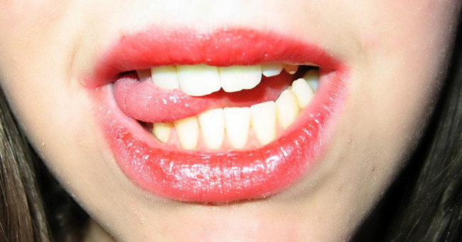 Bacterial buccal cavity, but why does the bite bite not get infected?
