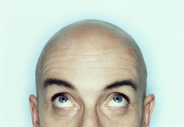Baldness is related to leadership