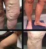 Be alert to abnormal changes in the body