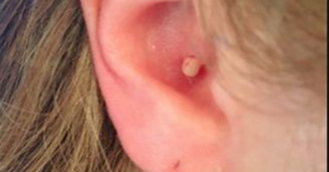 Be careful when you see your ear showing this sign